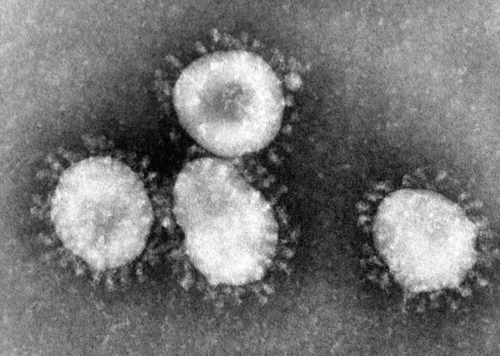 Een voorbeeld van een coronavirus onder een microscoop.